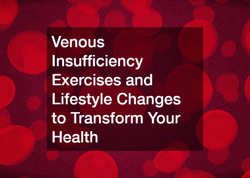 Venous Insufficiency Exercises and Lifestyle Changes to Transform Your Health